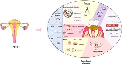 Bidirectional association between polycystic ovary syndrome and periodontal diseases